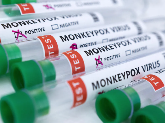 Peu de cas de variole simiesque recensés en Montérégie