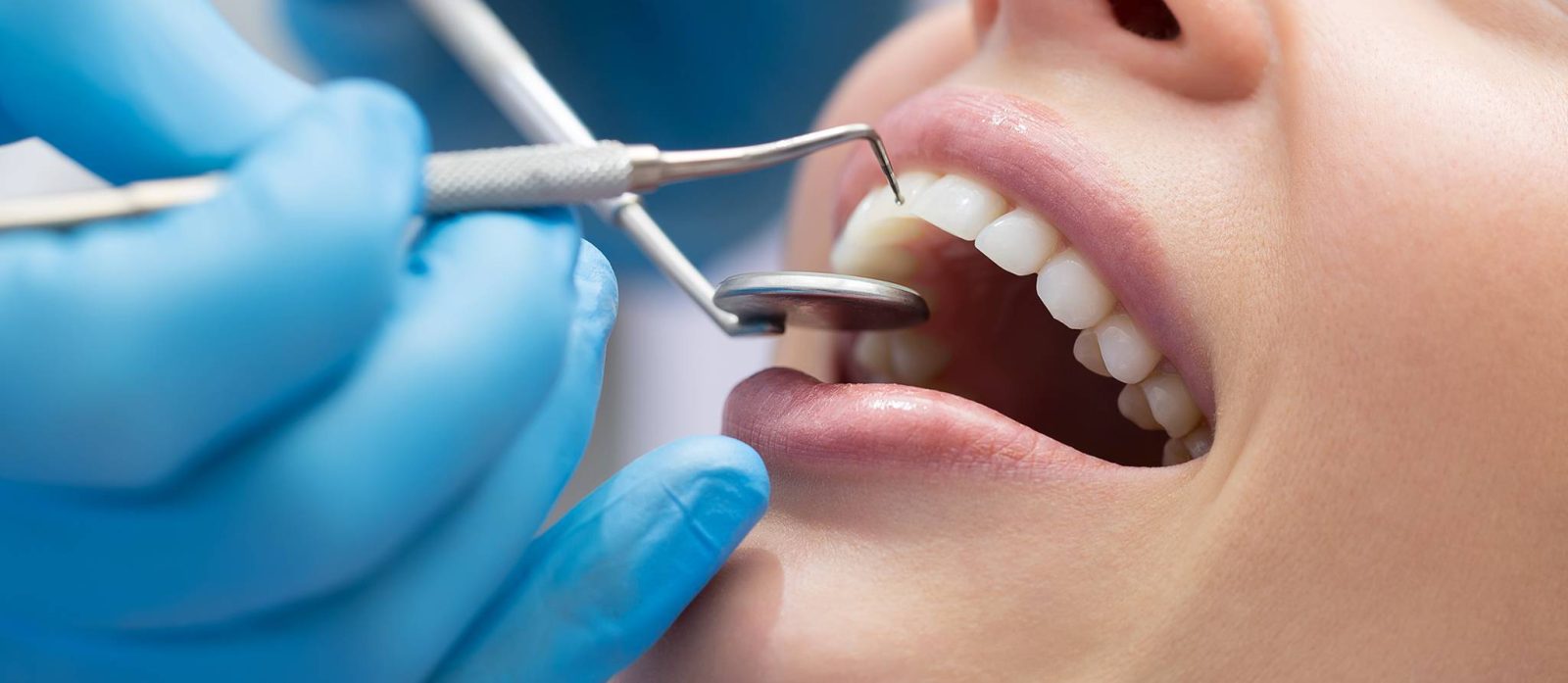Québec couvrira les soins dentaires médicalement requis